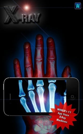 安卓手机扫描骨骼软件app