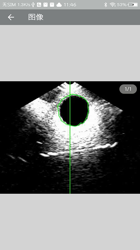 安卓m3无线超声测容软件app下载 1.2app